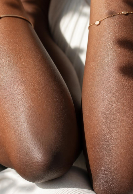 Hyperpigmentation du corps : coudes, genoux, aisselles, maillot